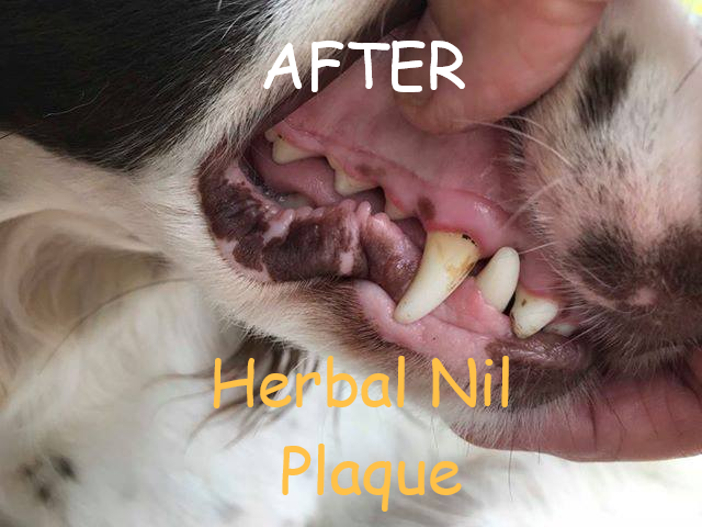 Nil Plaque for oral hygiene and plaque